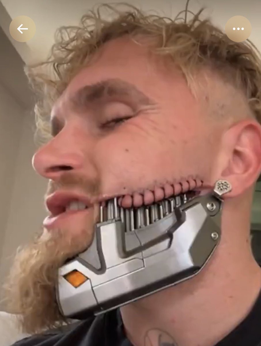 DAMI FOREIGN🥶 tweet media