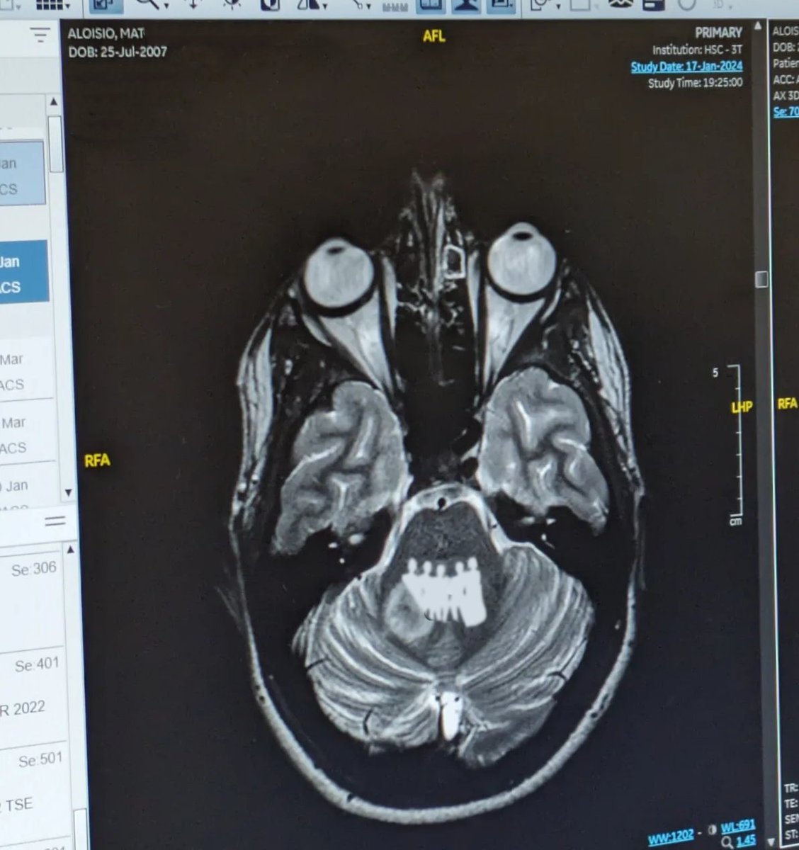 Mat, its U ☆ SEEING YVES 🌕💙 tweet media