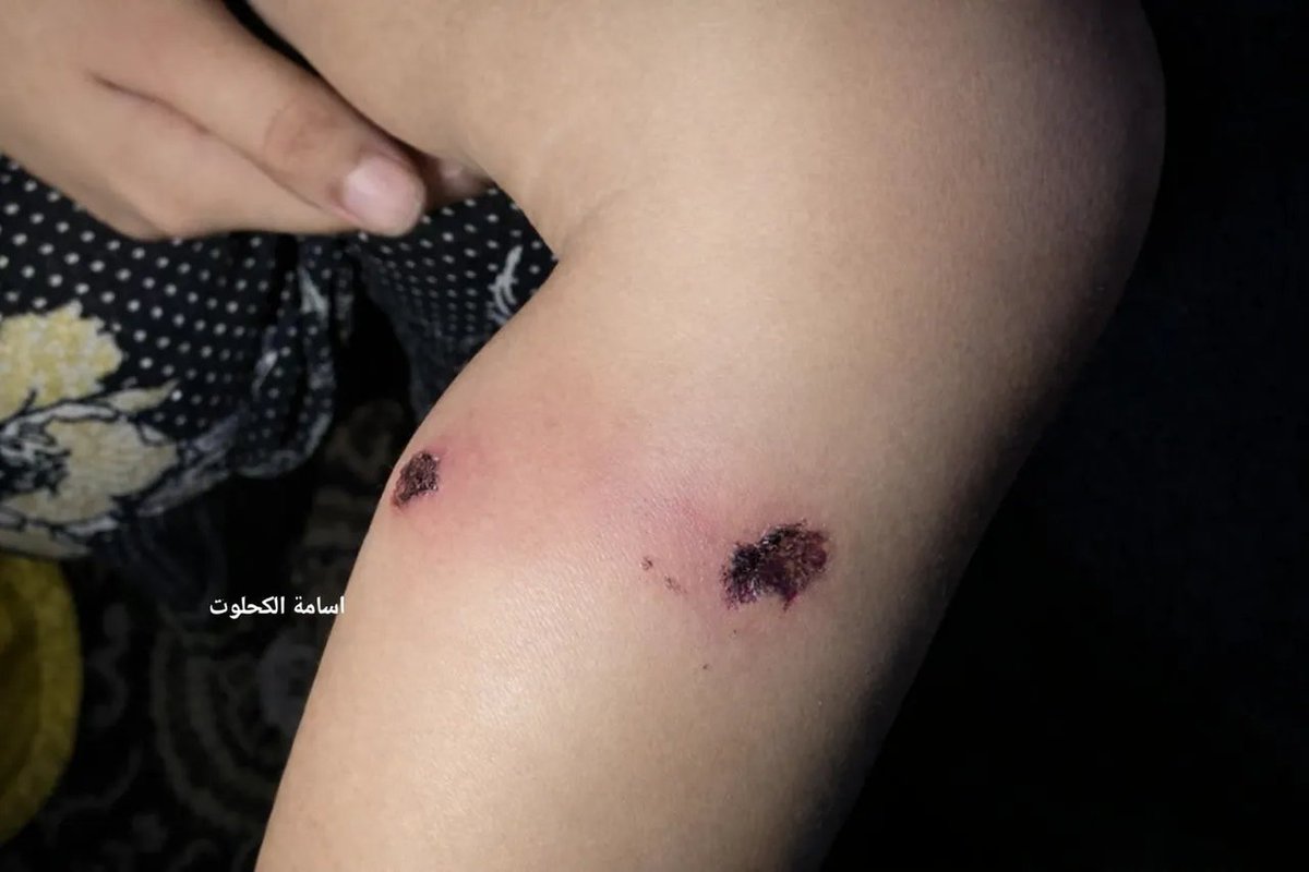 République tweet media