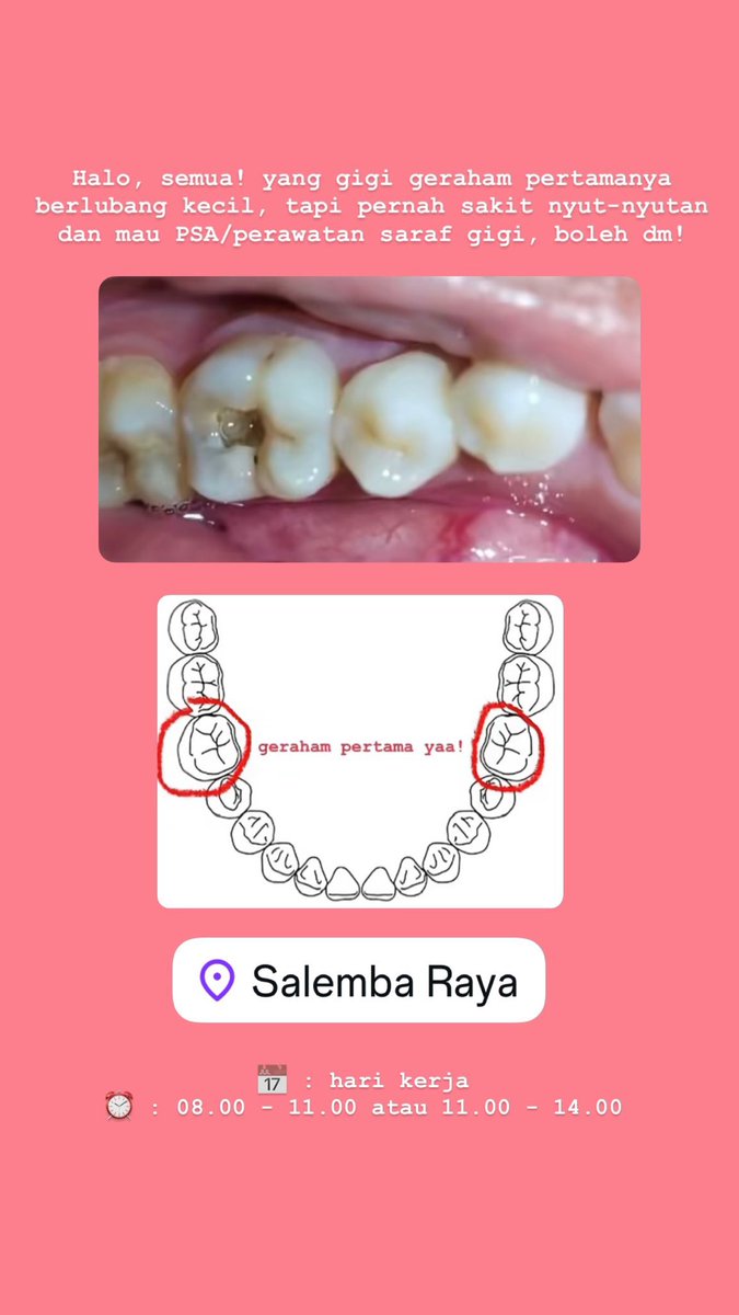 cheesecakeore10's tweet photo. [DICARI PASIEN PSA] 

halo, koas gigi jakarta is back! bagi semua yang punya kondisi :

Gigi berlubang (gigi geraham pertama) dgn riwayat nyeri tiba2

&amp; ingin dilakukan PERAWATAN SALURAN AKAR gratis (jam 8 - 13)

boleh dm yaa! <3

#koasgigijakarta #perawatansaluranakar https://t.co/Df8Cwy4cnv