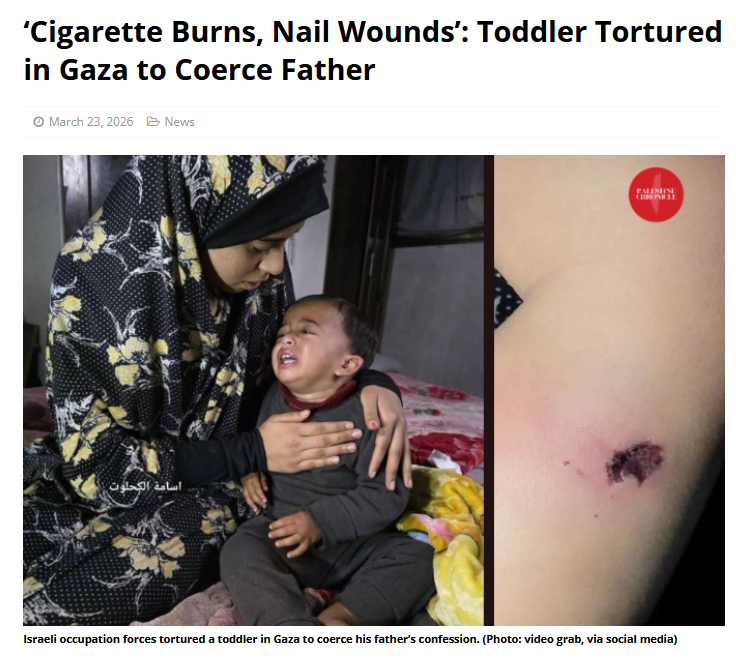 "UNCHILDING is the criminalization of the Palestinian and the sacralization and privileging of the colonizer... Children's bodies become a primary capital of dispossession..." Shalhoub-Kevorkian palestinechronicle.com/cigarette-burn…