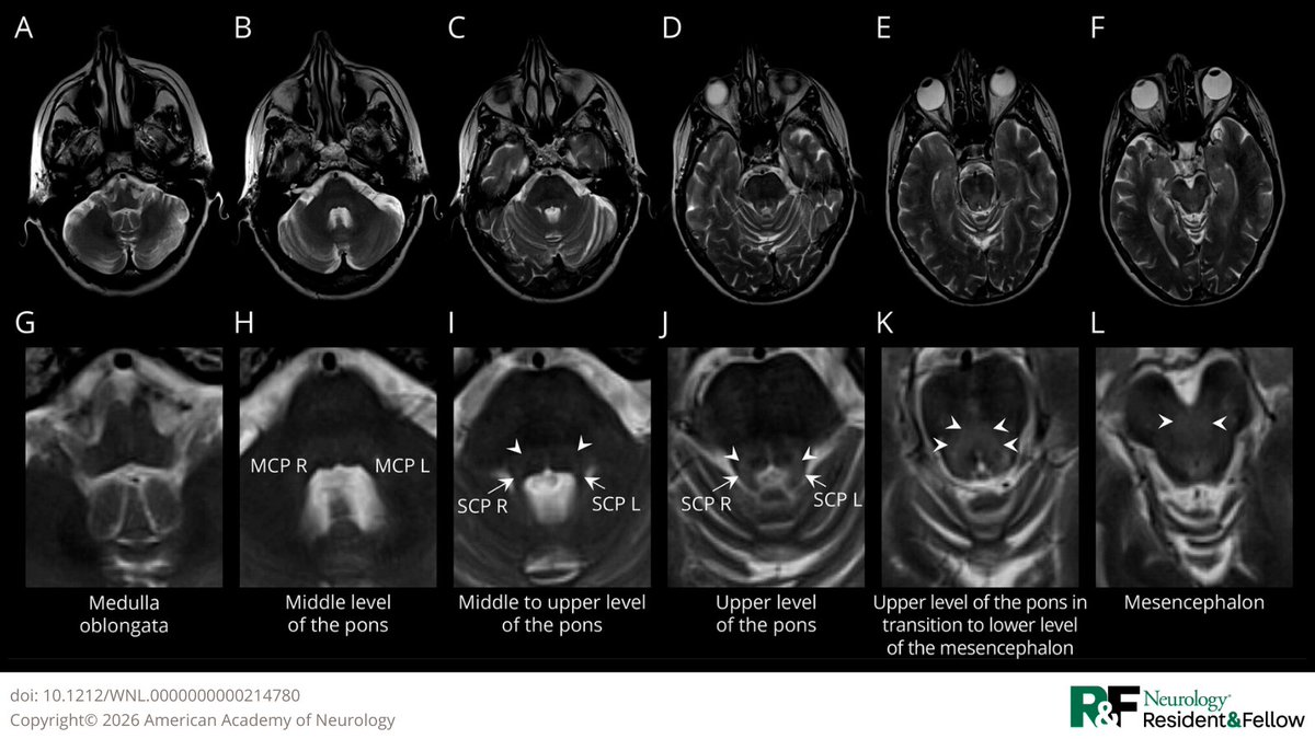 Neurology Journal tweet media