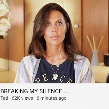 🧀😇 WORM! 🍚🐶 tweet media