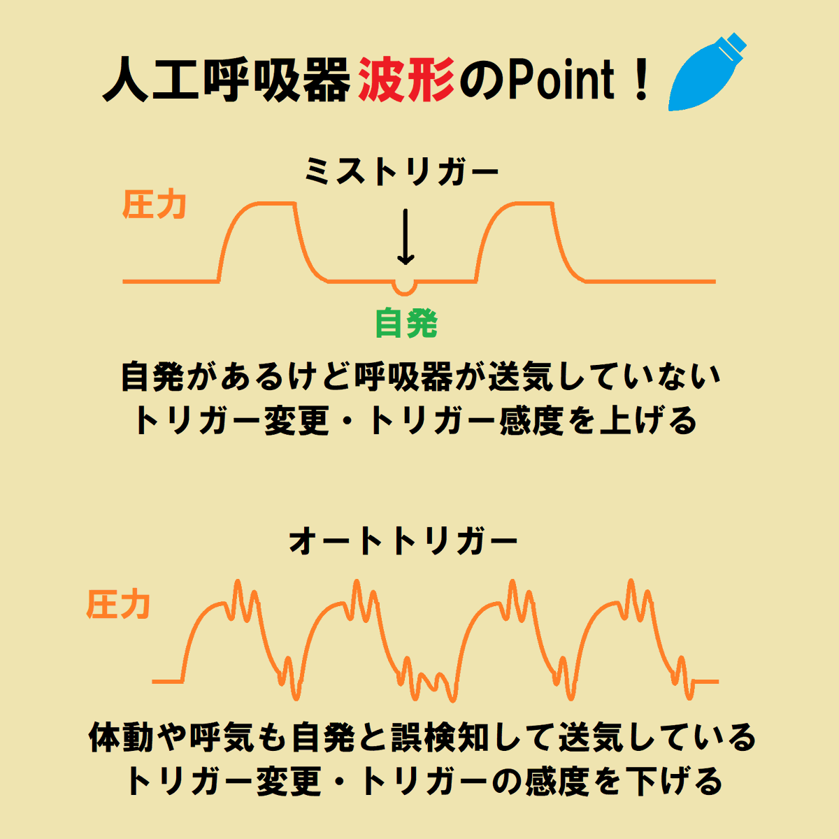ce7meliteracy's tweet photo. ICUでよく見る「人工呼吸器の波形」をまとめたよ！👏👏

波形ってね～、目で見えない情報を全力でアピれんのよ！それってもう・・・究極の愛じゃん！！✨👊✨👊 https://t.co/op4sXPmMns