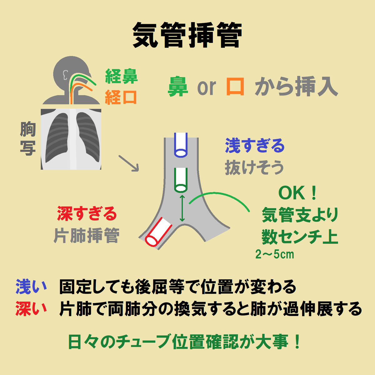 ce7meliteracy's tweet photo. 人工呼吸で使う「挿管チューブ」をまとめたよ！👏👏

ただの管なのに、こんなに種類あるの？😆💫

これでレべチ間違いナシ！🤝 https://t.co/Yacr81Z6B2