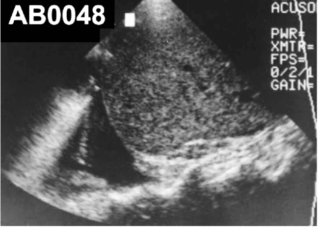 POCUSAcademy's tweet photo. Our case of the week has been posted! Follow us on LinkedIn, Instagram, or Facebook to review the case + share your answer.
LinkedIn: https://t.co/kZYbyO85GJ
Instagram: https://t.co/hinJ9zoZv0
Facebook: https://t.co/RABHh9Q34q
#POCUSCaseStudyChallenge https://t.co/kSXIuxSf6o