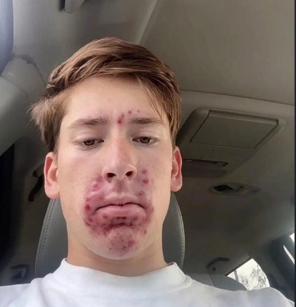 baskelebe's tweet image. All of you eating that #shit# ,this is the end result, continue o. Don't say I didn't warn you. The result may be visible now or in the nearest future.  Ire o.