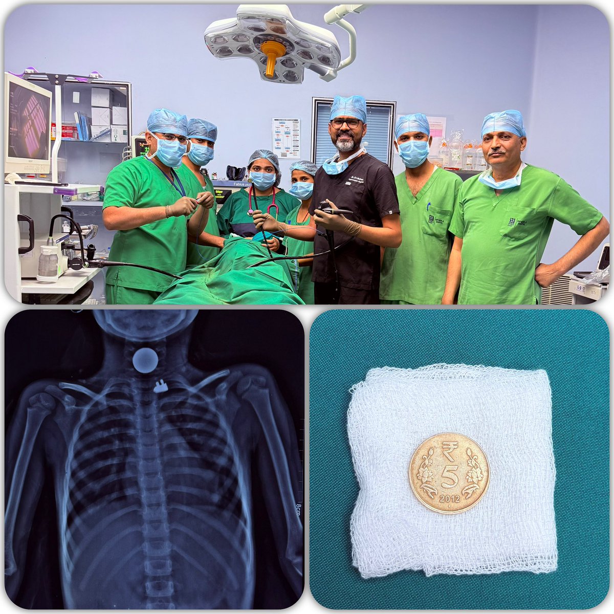 Dr. B L Bairwa MS, FACS tweet media