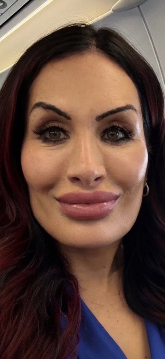 👀Wim🔰 tweet media