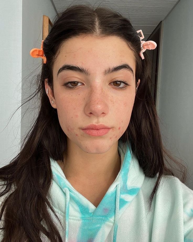 Simp for Charli tweet media