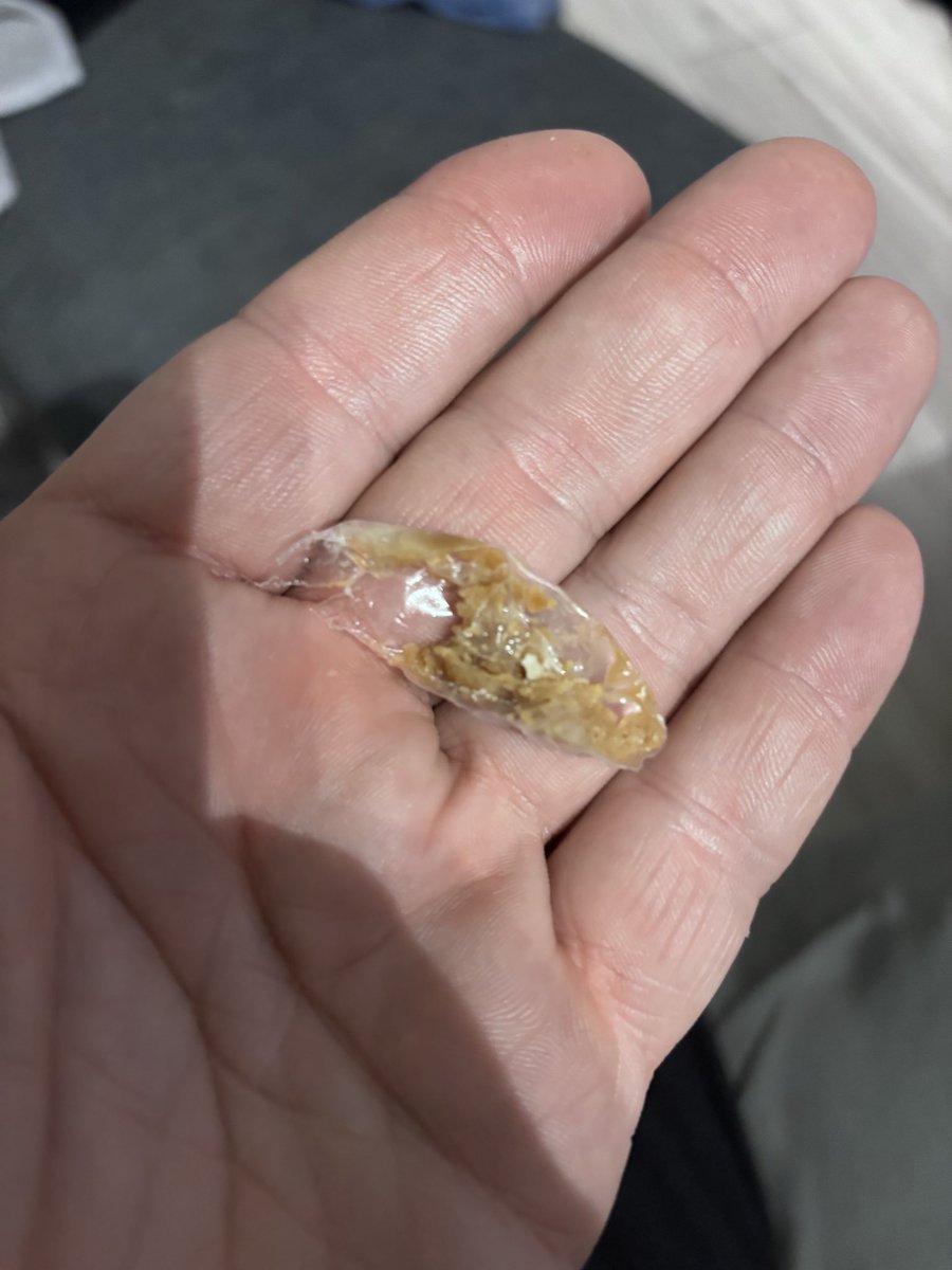 Dean Tansley 💙 tweet media