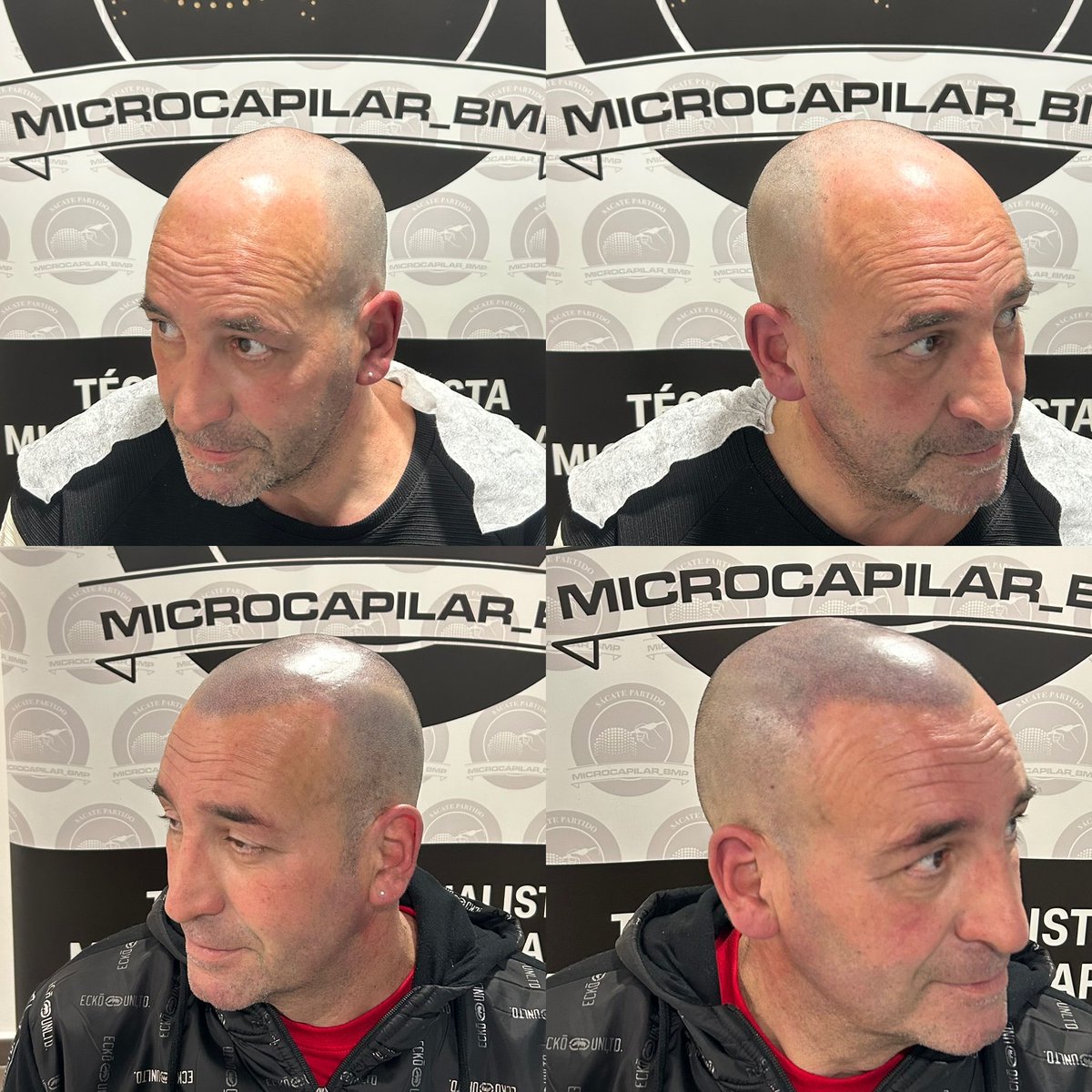 BMP Estética y Micropigmentacion tweet media