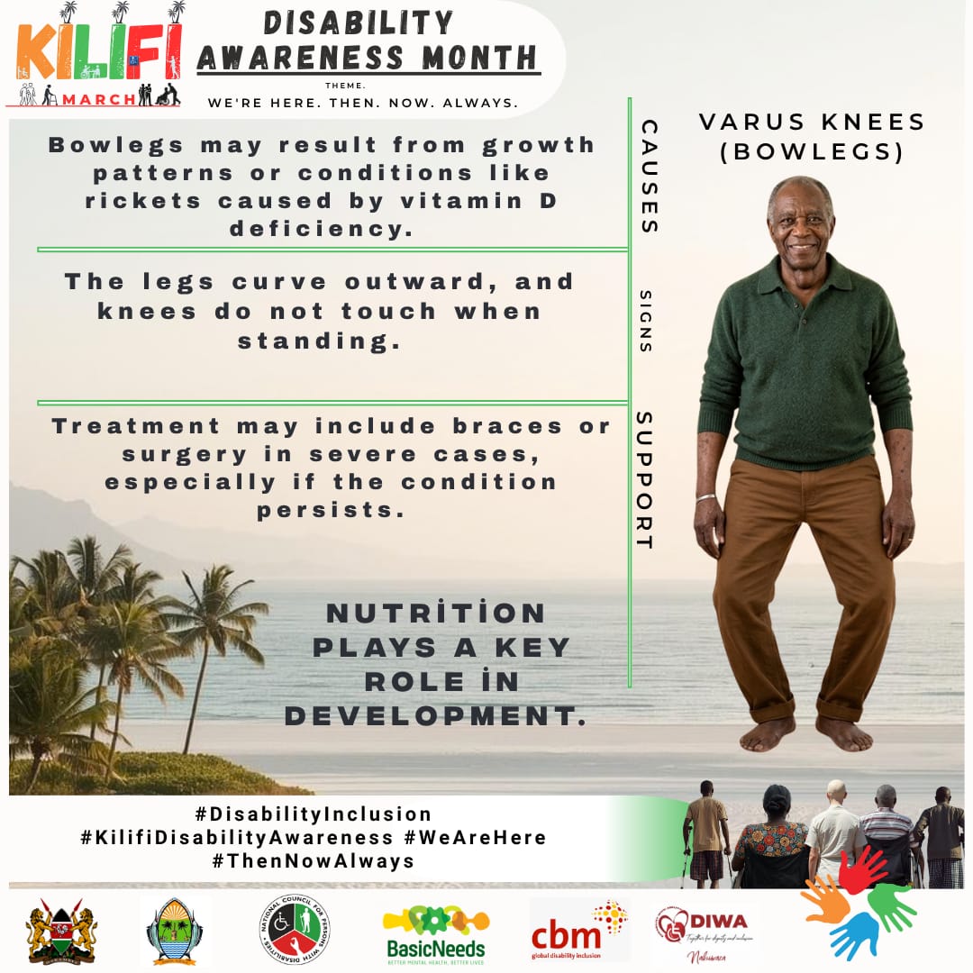 Roda Nzawa tweet media