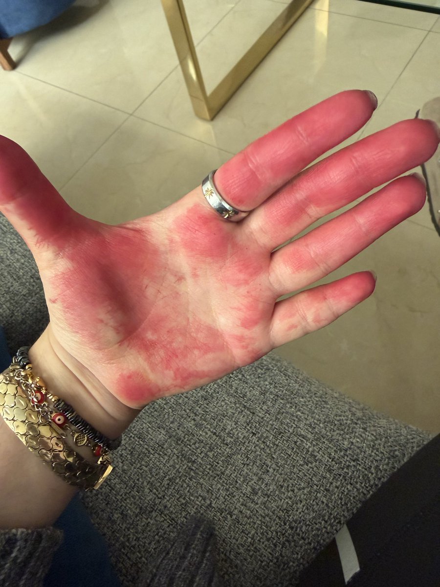 hopepaopao's tweet photo. i’ve been listening to arirang for 3 days straight nonstop
i’m turning red #btsimpact https://t.co/fZigmSaSEJ