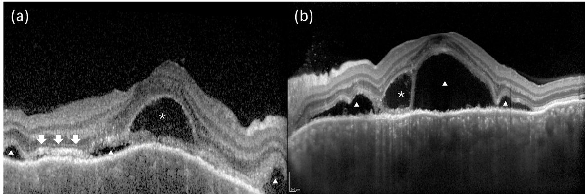 Ophthalmology tweet media