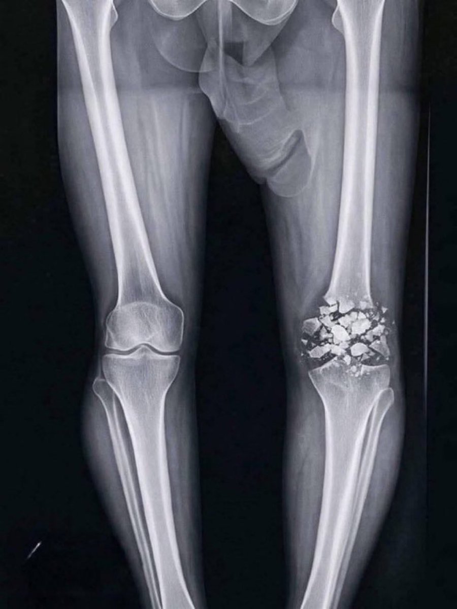 hills ❦ tweet media