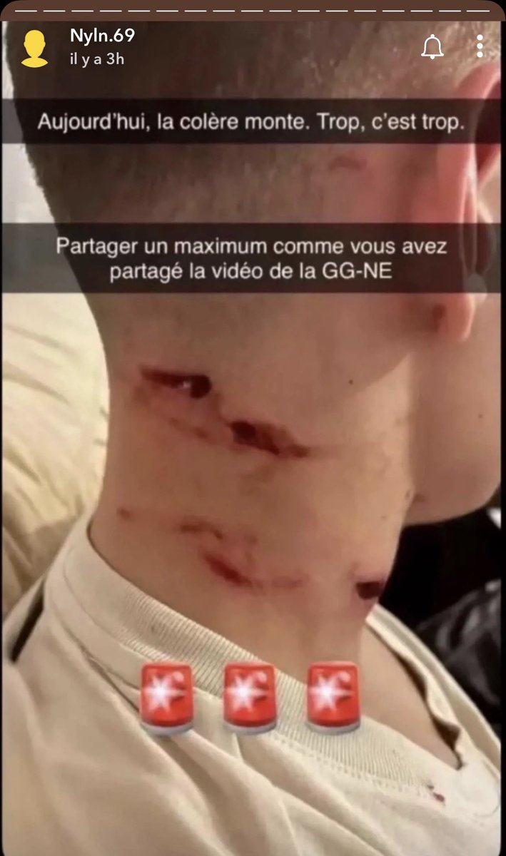 Renoi Type 0 🇨🇮 tweet media