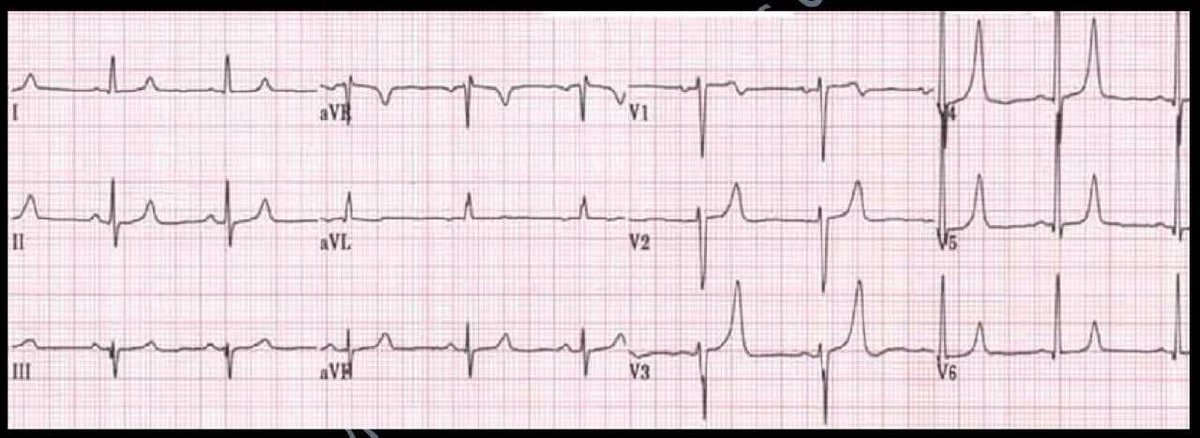 C.Alberto Ortega tweet media