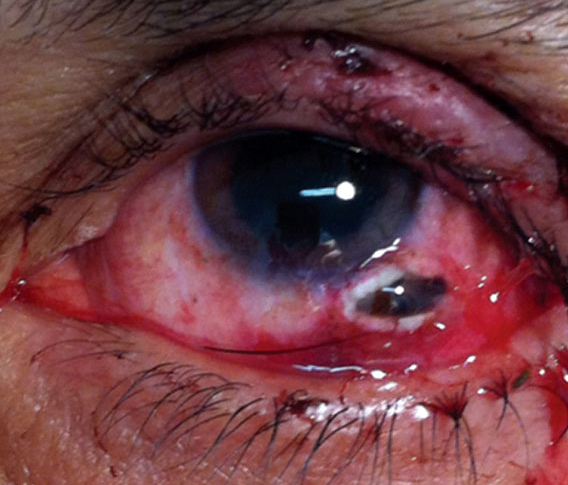 Review of Optometry tweet media