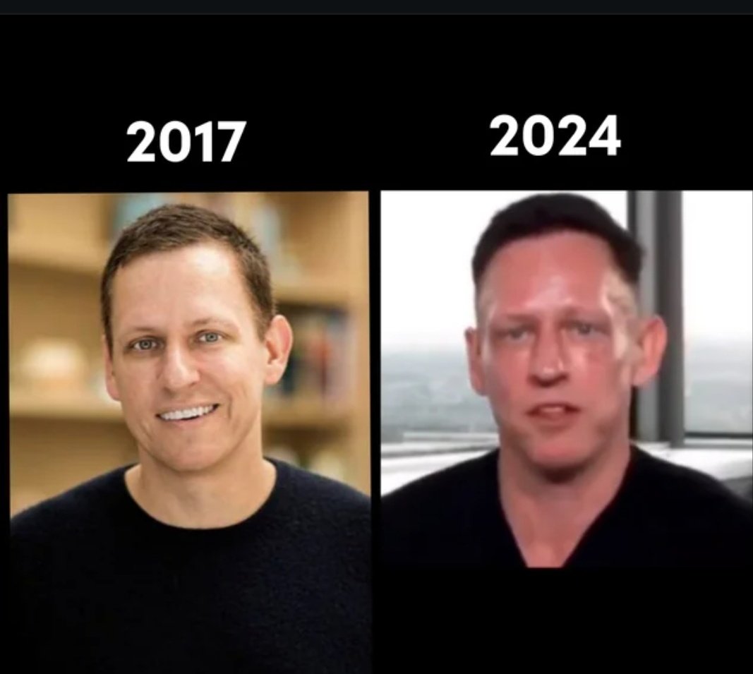 _Marnie_Andi's tweet photo. @joni_askola Thiel tech-billionaire bro is obsessed with reversing aging, he's keen on technologies designed to make skin tissues appear more youthful
Billionaires don't have ppl to tell the "It ain't fooling anyone"
#ThickerSkin https://t.co/fCrT4M71VM
