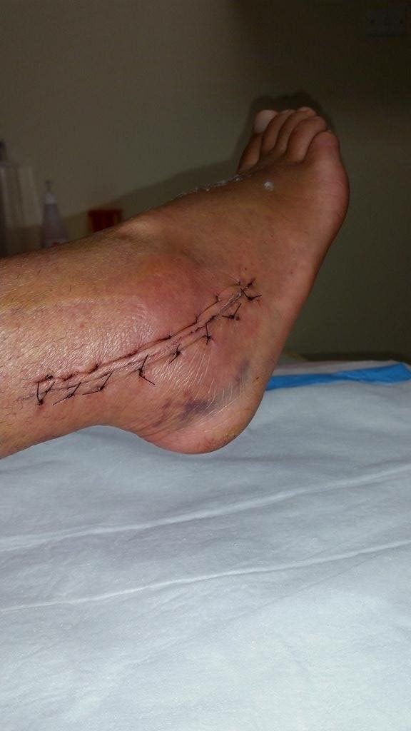 Li na🌸 tweet media