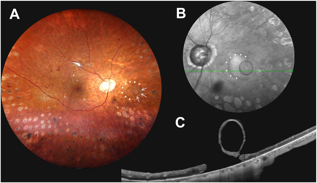 Ophthalmology tweet media