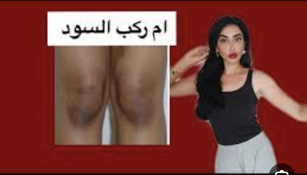 🇪🇬 Foksh37 tweet media