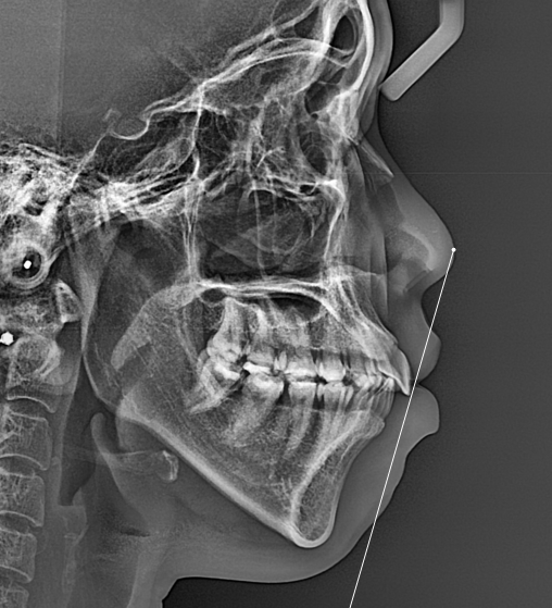 【公式】ル歯科 カンナム歯医者(le:dental clinic) tweet media