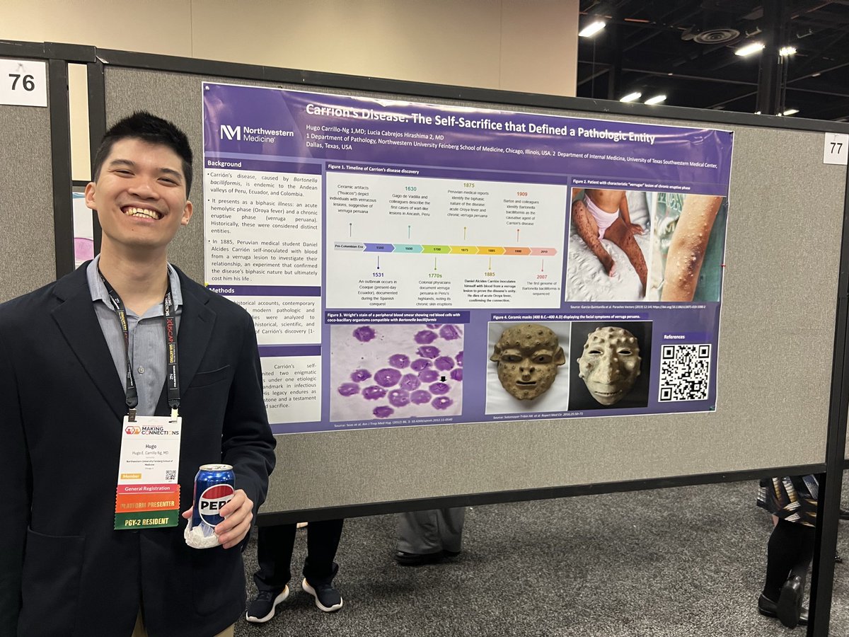 JaredAhrendsen's tweet photo. Fantastic showing by @NU_Pathology residents/fellows at #USCAP2026. Monday poster session Part 2: Drs. Hugo Carillo-Ng, Ahmed Mohamed 🤠, Stanislav (Stas) Fridland, and Jeanne Camille Cardenas. 
#PurplePath #Pathology https://t.co/D1gDLjR1qO