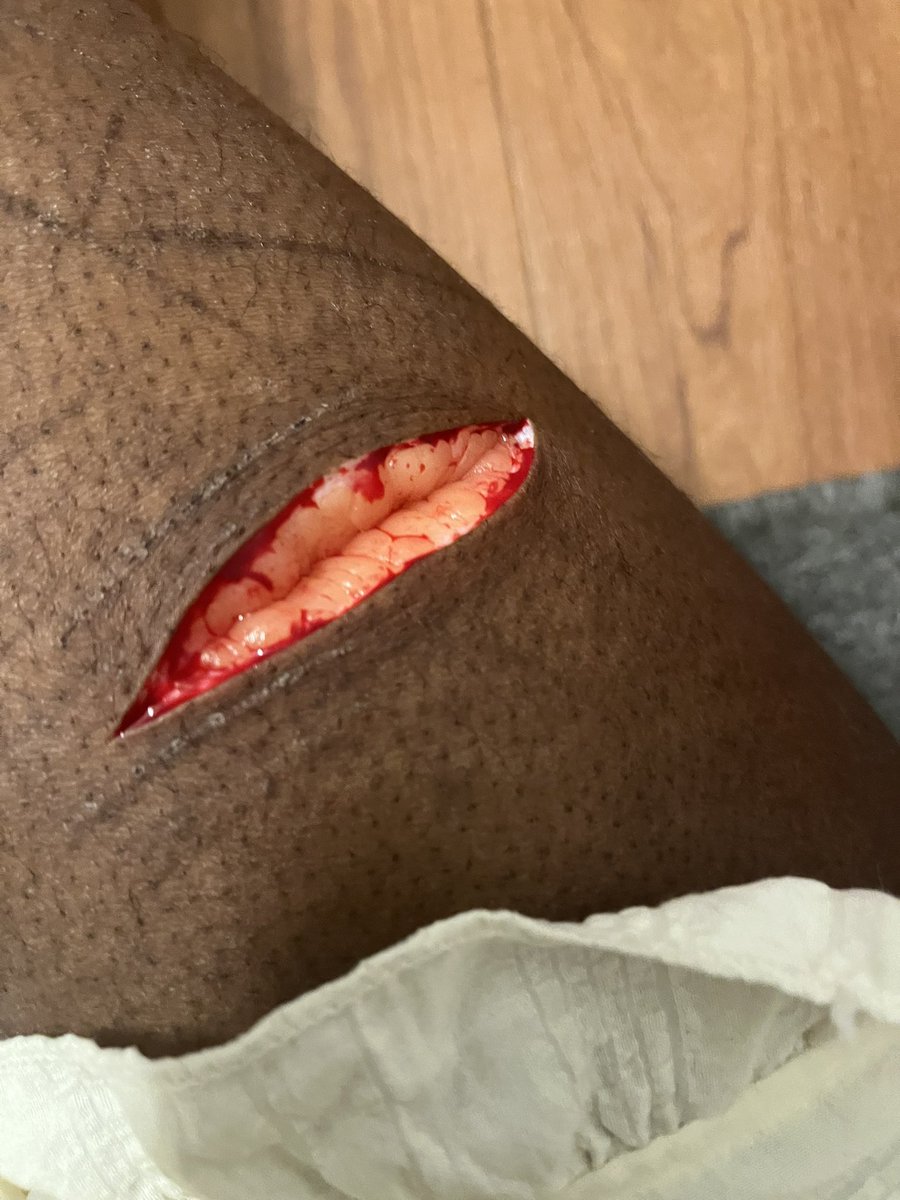 Mimi໒꒰ྀི๑ᵔ ᵕ ᵔ๑꒱ྀིაshedtwt tweet media