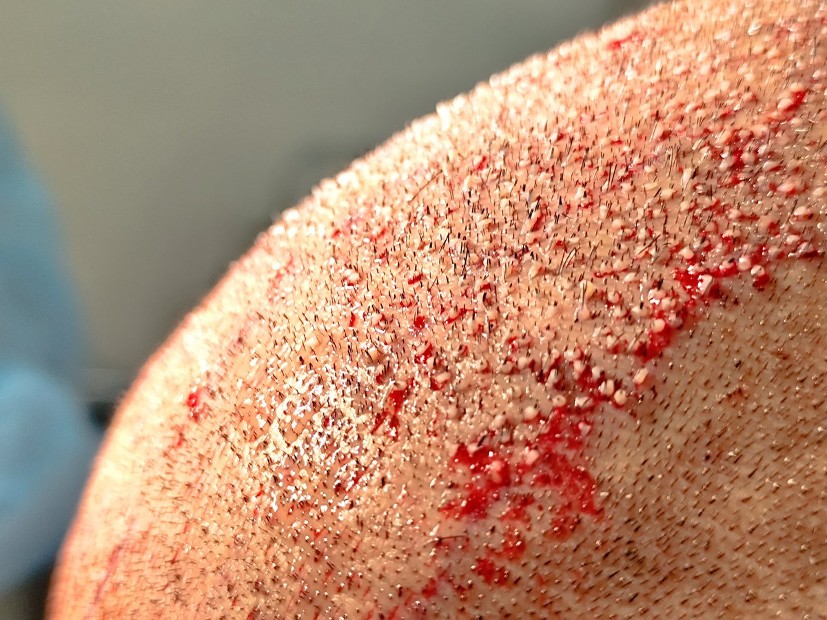 Carlos Álvarez✡️🇮🇱🇪🇸 tweet media