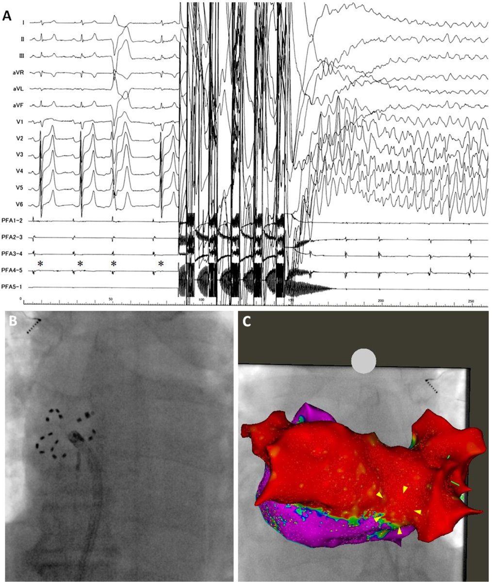 Heart Rhythm Case Reports tweet media