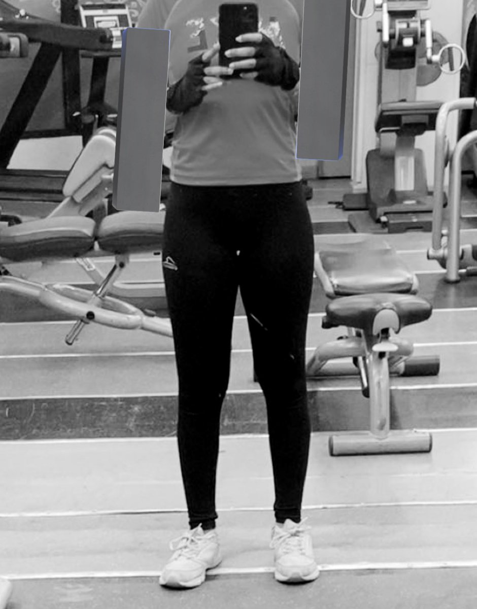 acids1ck's tweet photo. edtwt this is what b/p does to your body on the long run and now ITS so hard for me to lose weight normally no matter how much i restrict and i gained 15kg (30lb) even when i was b/p. don’t do it. i need help i just wanna go back to my lw. i hate mia. https://t.co/mn1B4668Fd