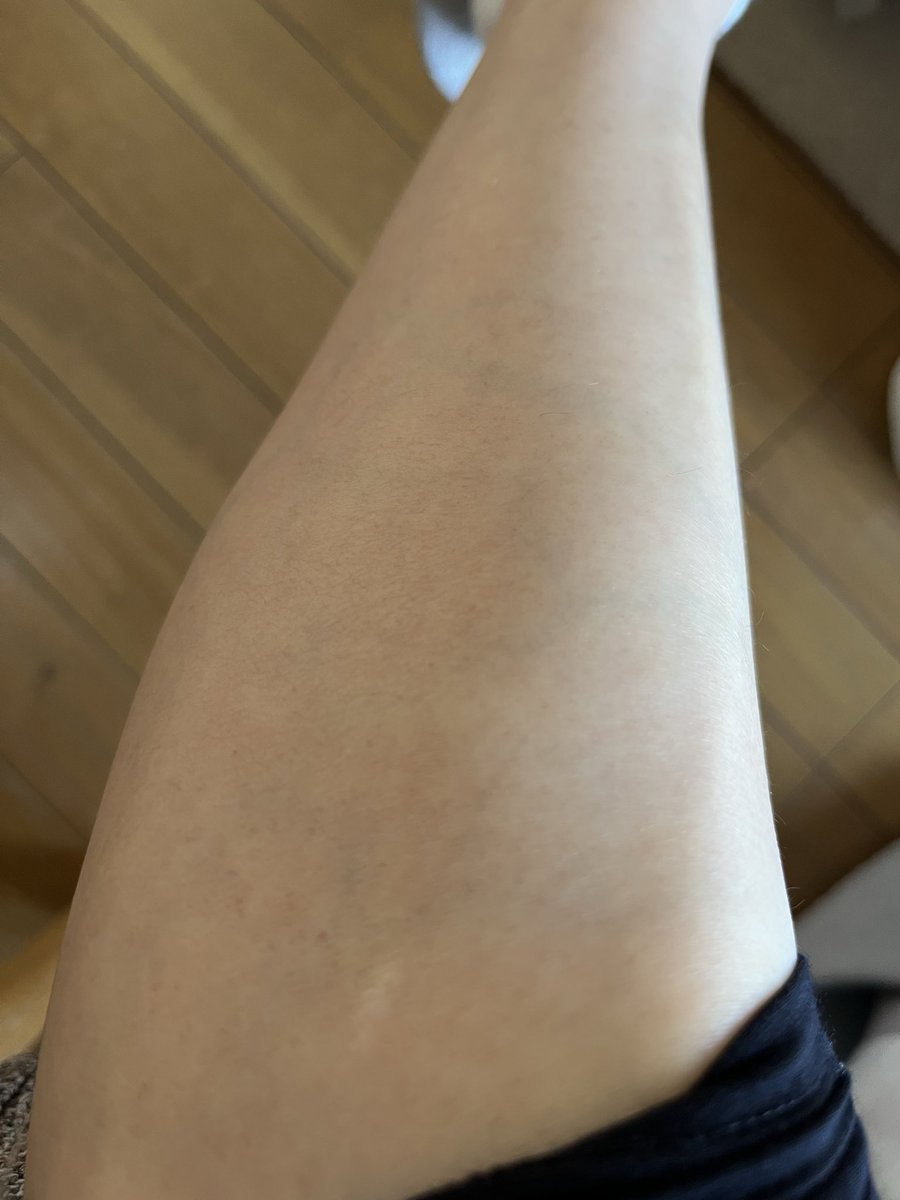 あんバター tweet media