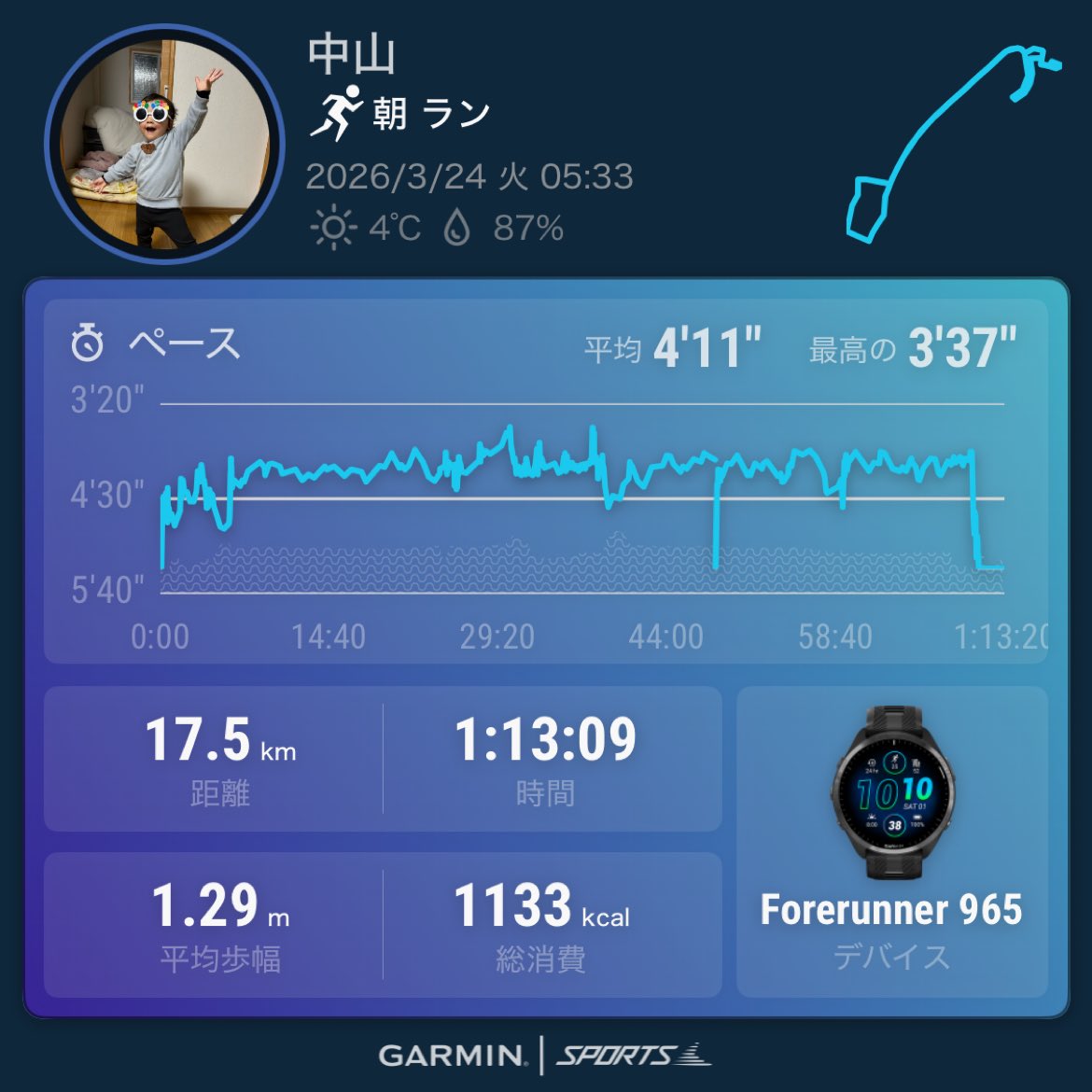 中山ʕ•̫͡• tweet media