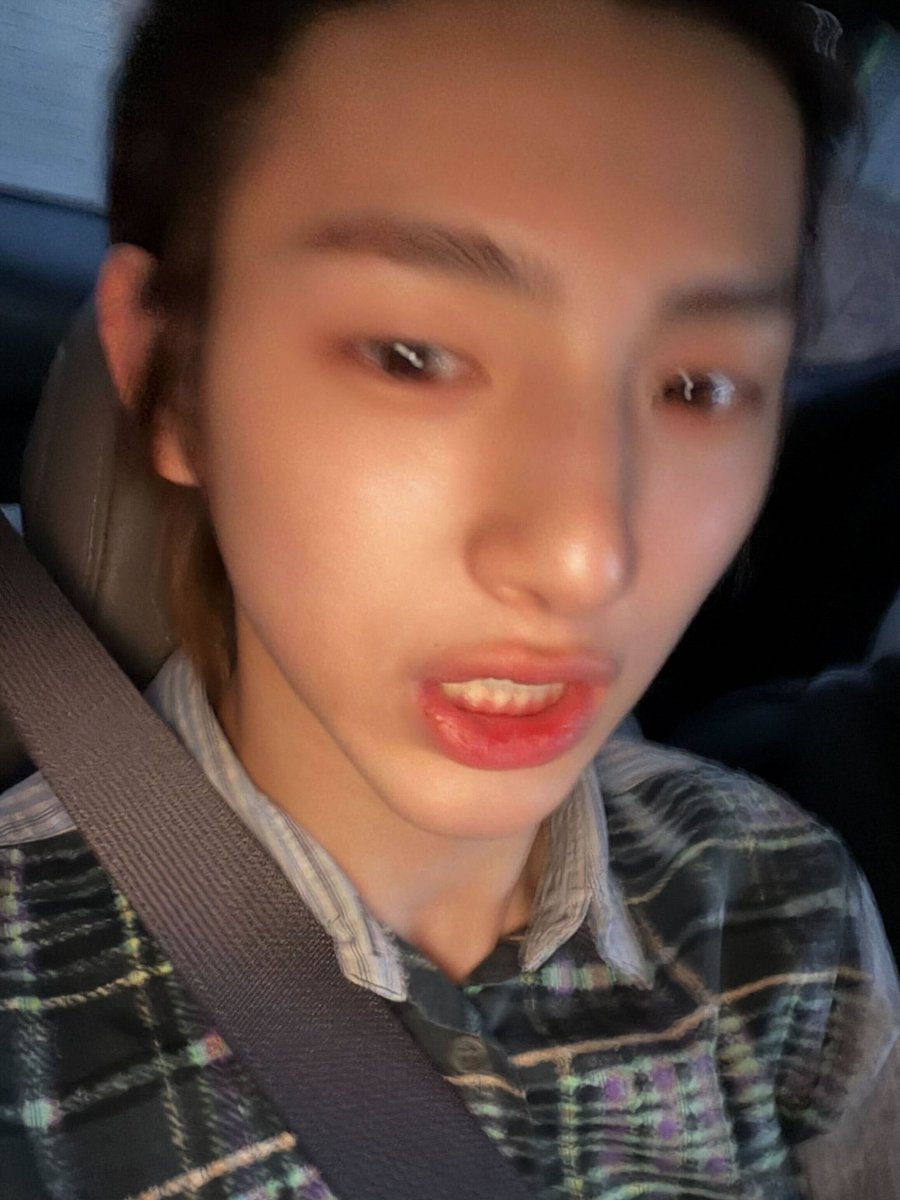 LIVE translation by©️크크 tweet media