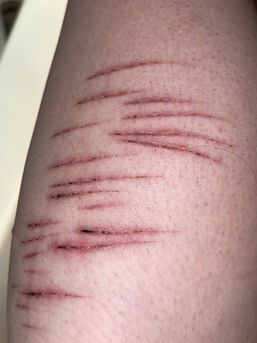 thomyorke of shedtwt 🐾 tweet media