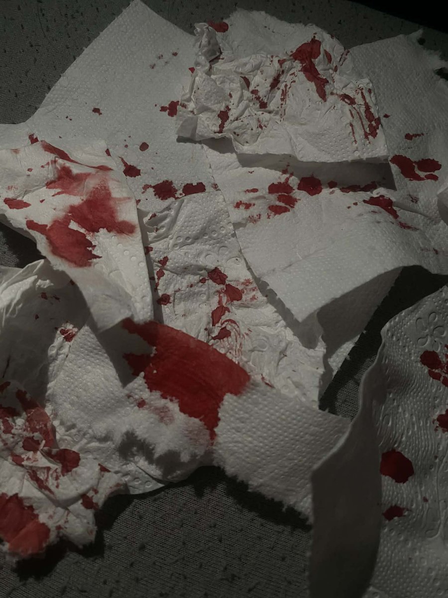 derealizacja tweet media