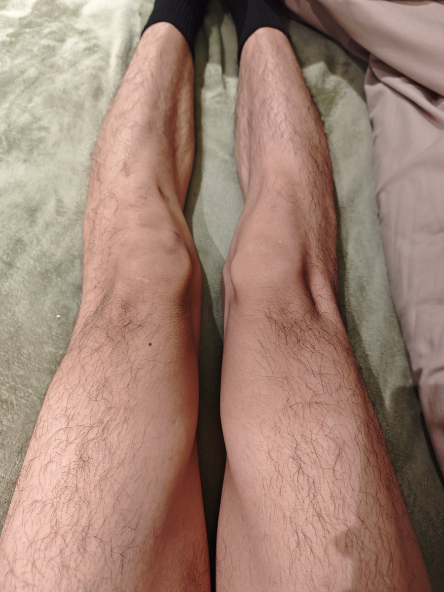 木头人ING tweet media