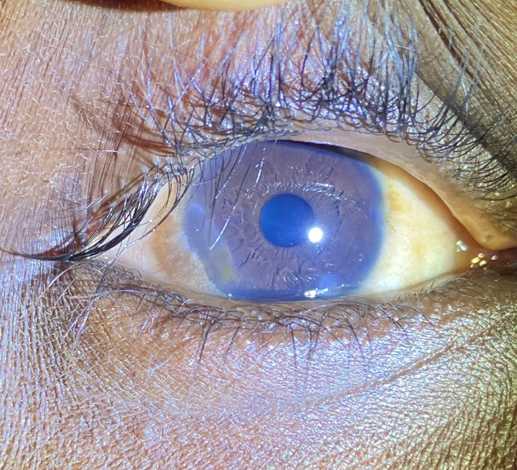 Gladys Atto tweet media