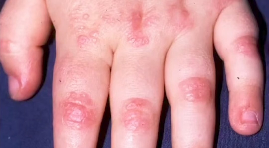 nervemed tweet media