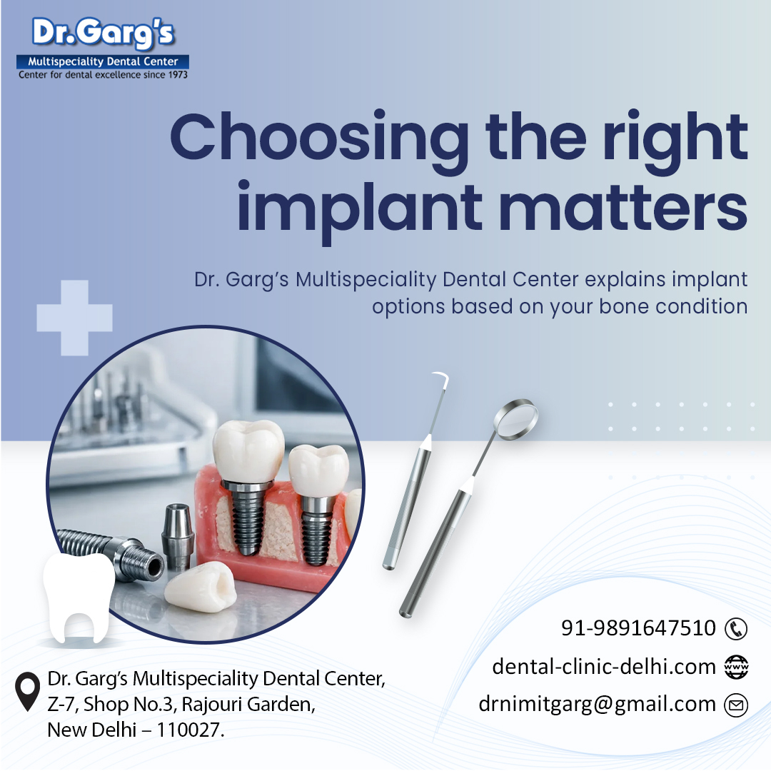 🦷 Choosing the Right Implant Matters!

Not all dental implants are the same — the right choice depends on your bone condition, oral health, and long-term needs.

#DentalImplants #SmileMakeover #OralHealth #DentalCare #HealthySmile #ImplantDentistry #DentistDelhi #Tooth