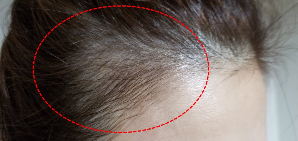 ミジュ🧴 tweet media