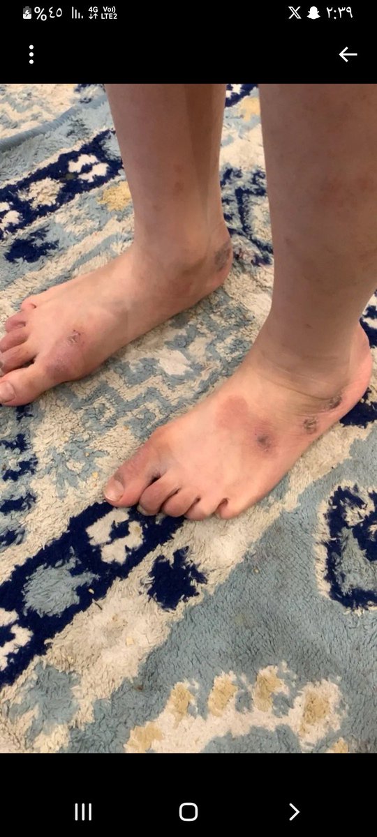 مشعل tweet media