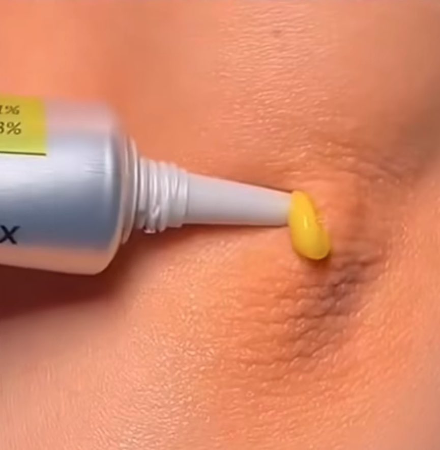 ilonaraa tweet media