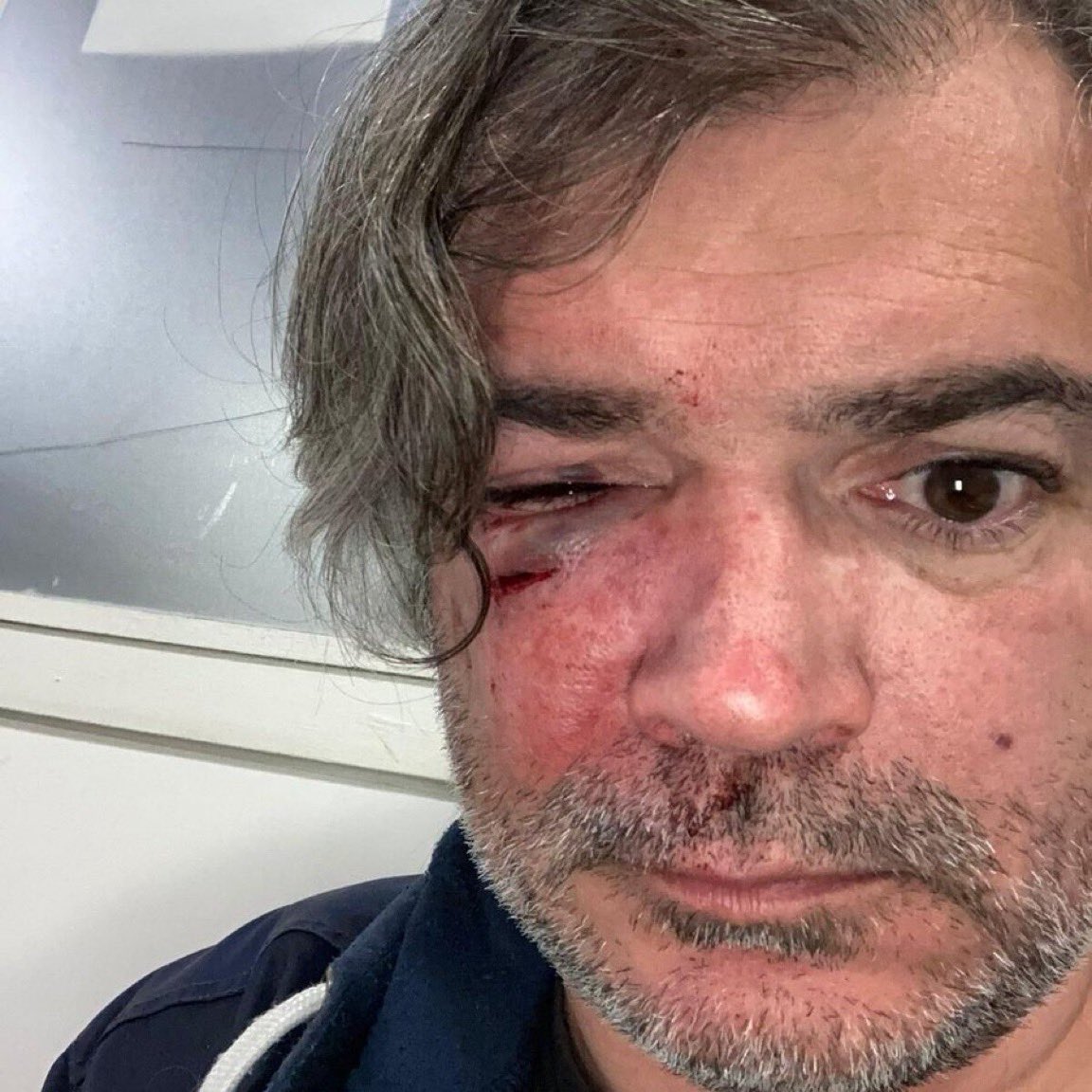 Thomas Portes tweet media