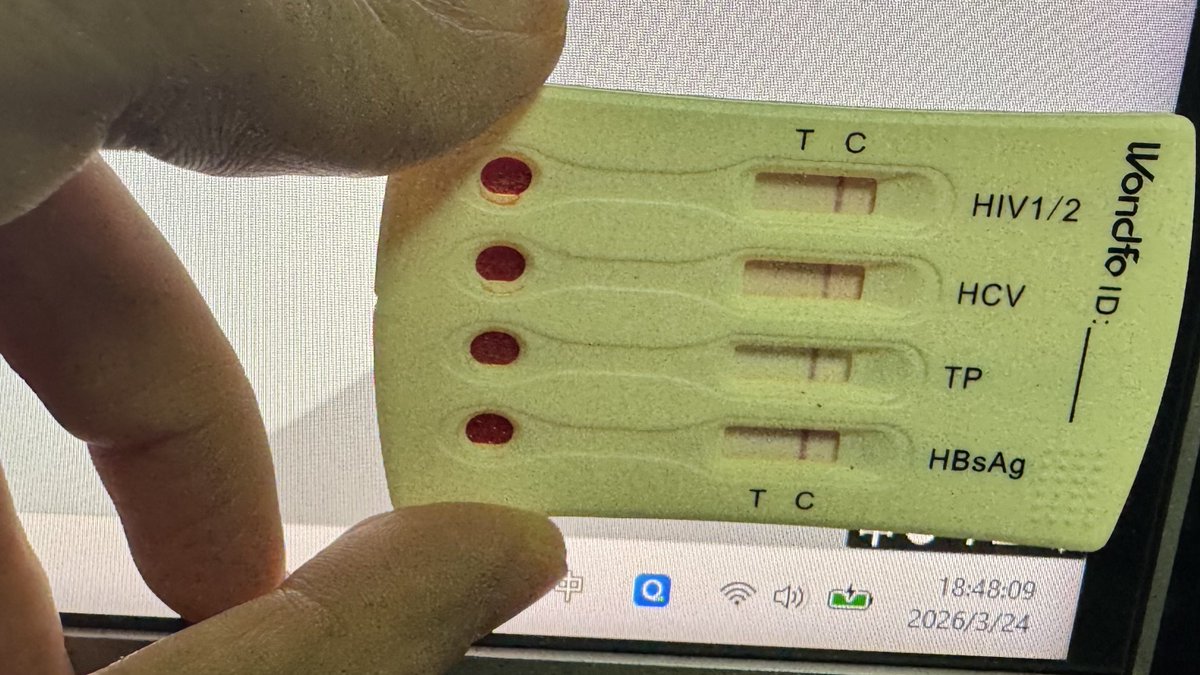 潘多拉盒子里有什么 tweet media