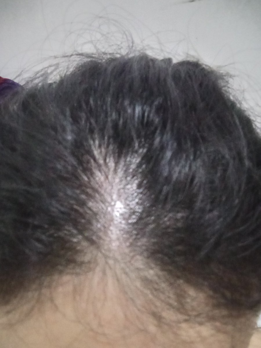 🐣🍉 tweet media