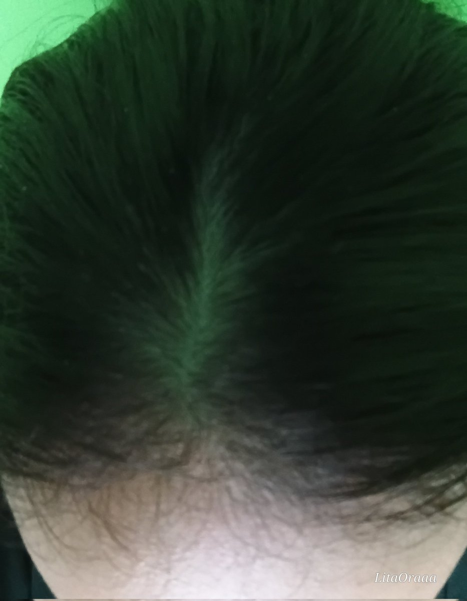 🐣🍉 tweet media