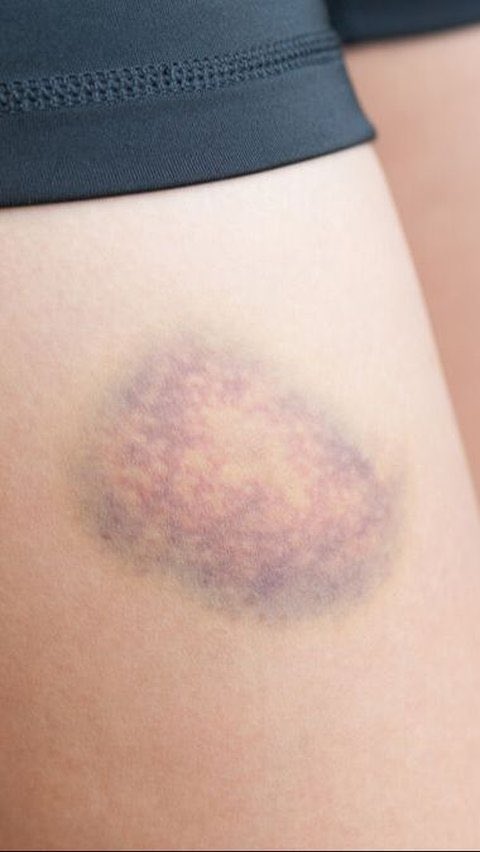 Яizal do tweet media